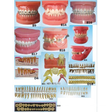 Oral Science Education Equipment Orthodontic Model Dental Model